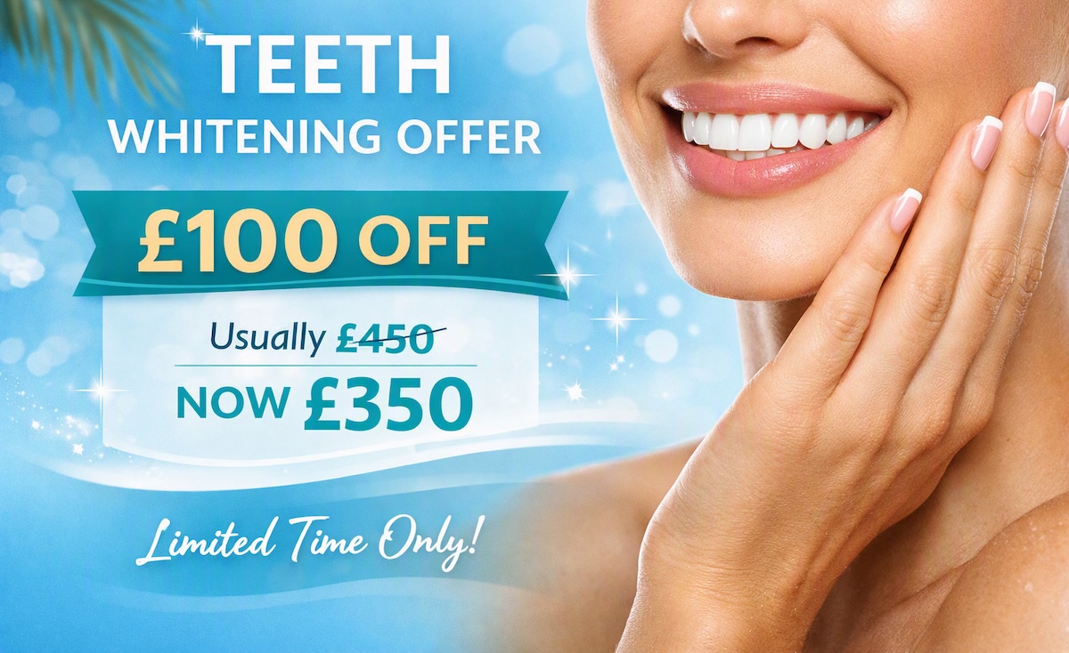 Teeth Whitening Offer August 26